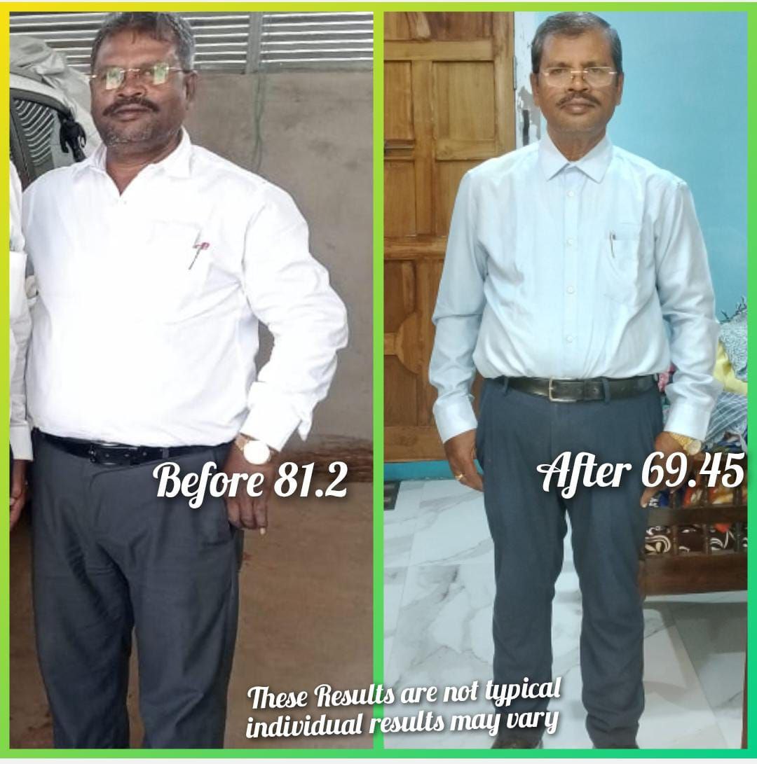 Before-and-after transformation shared by Smiling Transformations community member 4